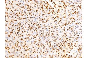 ABIN6267267 at 1/100 staining human pituitary adenoma tissue sections by IHC-P.