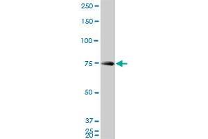 HNRPM monoclonal antibody (M03), clone 3F7.