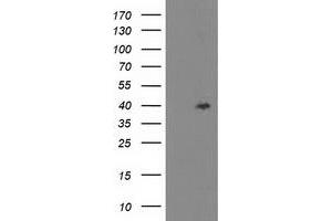Western Blotting (WB) image for anti-TBC1 Domain Family, Member 21 (TBC1D21) antibody (ABIN1501317) (TBC1D21 anticorps)