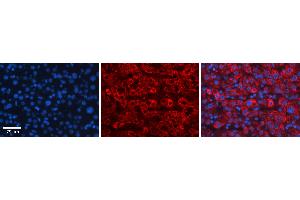 Rabbit Anti-FBXO21 Antibody Catalog Number: ARP43176_P050 Formalin Fixed Paraffin Embedded Tissue: Human Liver Tissue Observed Staining: Cytoplasm in hepatocytes Primary Antibody Concentration: 1:100 Other Working Concentrations: 1:600 Secondary Antibody: Donkey anti-Rabbit-Cy3 Secondary Antibody Concentration: 1:200 Magnification: 20X Exposure Time: 0.