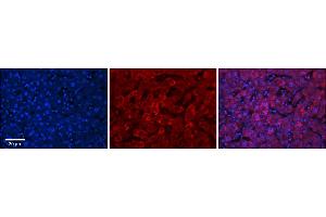 Rabbit Anti-UGT1A7 Antibody      Formalin Fixed Paraffin Embedded Tissue: Human Adult Liver   Observed Staining: Cytoplasm in hepatocytes, strong signal, wide tissue distribution  Primary Antibody Concentration: 1:100  Secondary Antibody: Donkey anti-Rabbit-Cy3  Secondary Antibody Concentration: 1:200  Magnification: 20X  Exposure Time: 0.