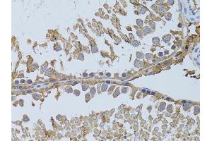Immunohistochemistry of paraffin-embedded rat testis using HDAC8 antibody (ABIN5973443) at dilution of 1/100 (40x lens). (HDAC8 anticorps)