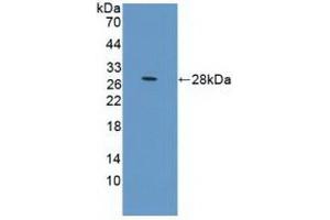 Detection of Recombinant PRLR, Human using Polyclonal Antibody to Prolactin Receptor (PRLR) (Prolactin Receptor anticorps  (AA 25-234))