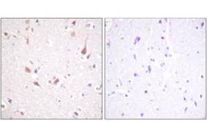 Immunohistochemistry analysis of paraffin-embedded human brain tissue, using Mst1/2 (Ab-183) Antibody. (MST1/MST2 (AA 149-198) anticorps)