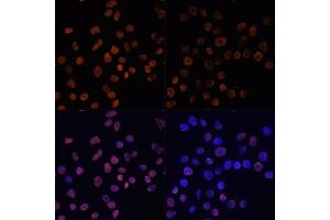 Immunofluorescence analysis of HeLa cells using Acetyl-Histone H2A-K5 antibody (ABIN7267722) at dilution of 1:100. (Histone H2A anticorps  (acLys5))