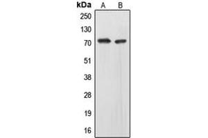 Western blot analysis of EOMES expression in HepG2 (A), IMR32 (B) whole cell lysates. (EOMES anticorps  (N-Term))