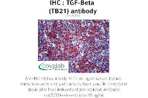Image no. 1 for anti-TGF-beta (TGFb) antibody (ABIN1723276) (TGF-beta anticorps)