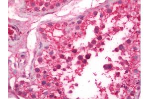 Human Testis: Formalin-Fixed, Paraffin-Embedded (FFPE)