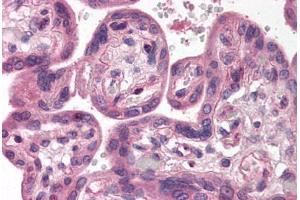 anti-SH3-Domain GRB2-Like Endophilin B1 (SH3GLB1) (C-Term) antibody