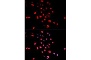 Immunofluorescence (IF) image for anti-Jun Proto-Oncogene (JUN) (pSer63) antibody (ABIN1870292) (C-JUN anticorps  (pSer63))