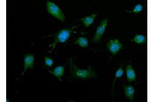 IF analysis of ZIP Kinase/Dapk3 using anti-ZIP Kinase/Dapk3 antibody (ABIN7601147).
