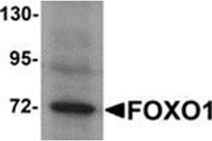 Western blot analysis of FOXO1 in Hela cell lysate with FOXO1 antibody at 1 μg/ml. (FOXO1 anticorps  (N-Term))