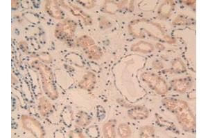 Detection of C1qA in Human Kidney Tissue using Polyclonal Antibody to Complement Component 1, Q Subcomponent A (C1qA)
