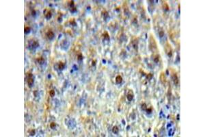 Used in DAB staining on fromalin fixed paraffin-embedded Liver tissue