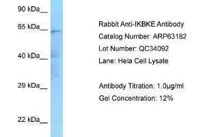 Western Blotting (WB) image for anti-Inhibitor of kappa Light Polypeptide Gene Enhancer in B-Cells, Kinase epsilon (IKBKE) (N-Term) antibody (ABIN2789403)