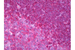 Anti-CD79B antibody IHC of human tonsil.