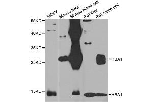Western blot analysis of extracts of various cell lines, using HBA1 antibody (ABIN4903869) at 1:1000 dilution. (HBA1 anticorps)