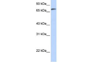 WB Suggested Anti-C14orf37 Antibody Titration:  0. (C14ORF37 anticorps  (N-Term))