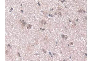 Detection of PSMa5 in Human Cerebrum Tissue using Polyclonal Antibody to Proteasome Subunit Alpha Type 5 (PSMa5)