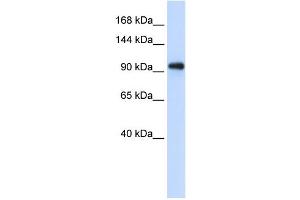 WB Suggested Anti-EXOSC10 Antibody Titration:  0. (EXOSC10 anticorps  (C-Term))