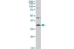CITED1 monoclonal antibody (M03), clone 5H6 Western Blot analysis of CITED1 expression in A-431 . (CITED1 anticorps  (AA 94-193))