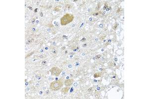Immunohistochemistry of paraffin-embedded rat brain using CST1 antibody (ABIN5975714) at dilution of 1/100 (40x lens). (CST1 anticorps)