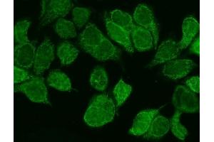 IF analysis of WNT8B using anti-WNT8B antibody (ABIN7600580).