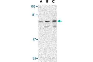 Western blot analysis of PTPN11 in mouse skeletal muscle tissue lysate with PTPN11 polyclonal antibody  at (A) 0. (PTPN11 anticorps  (C-Term))