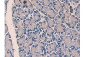 Detection of UCN in Rat Pancreas Tissue using Polyclonal Antibody to Urocortin (UCN)