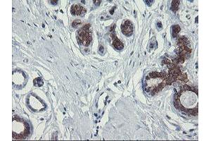 Image no. 11 for anti-Polymerase (RNA) III (DNA Directed) Polypeptide C (62kD) (POLR3C) antibody (ABIN1500340)