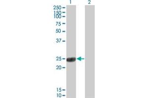 Western Blot analysis of COMT expression in transfected 293T cell line by COMT monoclonal antibody (M01), clone 1G4-1A1.
