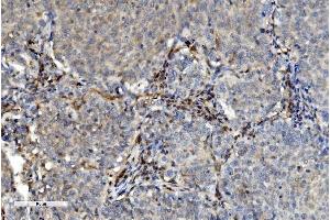 IHC analysis of PNP using anti-PNP antibody (ABIN7602997). (PNP anticorps  (Middle Region))