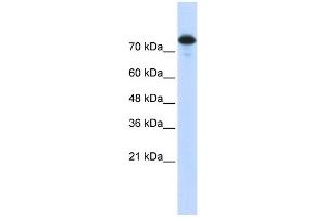 WB Suggested Anti-WWP2 Antibody Titration:  0. (WWP2 anticorps  (Middle Region))