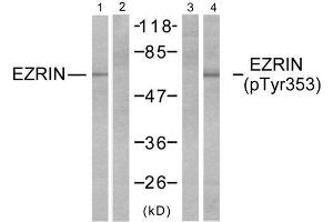 Western blot analysis of extracts from A431 cells, untreated or EGF-treated (200ng/ml, 30min) using Ezrin (Ab-353) antibody (E021094, Lane 1 and 2) and Ezrin (phospho-Tyr353) antibody (E011063, Lane 3 and 4).