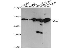 Western blot analysis of extracts of various cell lines, using GALM antibody (ABIN6292969) at 1:3000 dilution. (GALM anticorps)