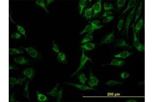 Image no. 4 for anti-Chromosome 21 Open Reading Frame 33 (C21orf33) (AA 188-269) antibody (ABIN599034) (C21orf33 anticorps  (AA 188-269))