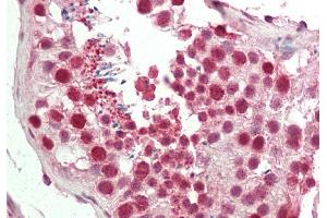 Rabbit Anti-CBX3 antibody  Formalin Fixed Paraffin Embedded Tissue: Human Testis Primary antibody Concentration: 1:100 Secondary Antibody: Donkey anti-Rabbit-Cy3 Secondary Antibody Concentration: 1:200 Magnification: 20x Exposure Time: 0. (CBX3 anticorps  (Middle Region))