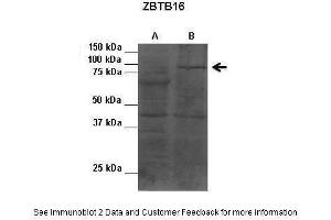 Lanes:   1. (ZBTB16 anticorps  (C-Term))