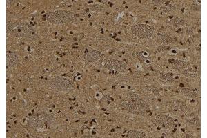 ABIN6272947 at 1/100 staining Rat brain tissue by IHC-P.