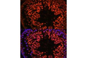 Immunofluorescence analysis of rat testis using UBQLN3 antibody (ABIN7271123) at dilution of 1:100.