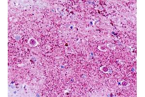 Human, Brain, Cortex: Formalin-Fixed Paraffin-Embedded (FFPE) (GPR173 anticorps  (C-Term))