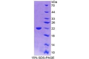 SDS-PAGE of Protein Standard from the Kit (Highly purified E. (IL-18 Kit ELISA)