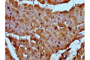 IHC image of ABIN7160664 diluted at 1:300 and staining in paraffin-embedded human heart tissue performed on a Leica BondTM system. (MYOZ2 anticorps  (AA 90-180))