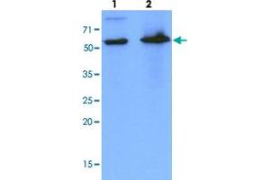 Western blot analysis of cell lysates (each 40 ug) by PDZK1 monoclonal antibody, clone AT1A2  (1:1000). (PDZK1 anticorps  (AA 1-519))