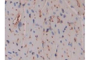 Detection of PZP in Mouse Heart Tissue using Polyclonal Antibody to Pregnancy Zone Protein (PZP)