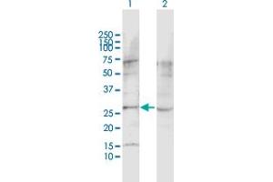 Western Blot analysis of LPHN1 expression in transfected 293T cell line by LPHN1 MaxPab polyclonal antibody. (Latrophilin 1 anticorps  (AA 1-201))