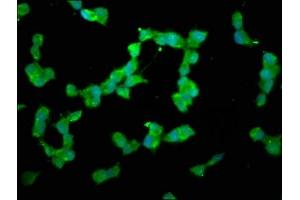anti-Dual Specificity Phosphatase 26 (DUSP26) (AA 1-211) antibody