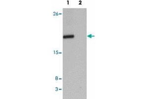 Western blot analysis of CXXC4 in human brain tissue lysate with CXXC4 polyclonal antibody  at 1 ug/mL in (1) the absence and (2) the presence of blocking peptide. (CXXC4 anticorps  (N-Term))