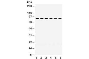 Western blot testing of 1) mouse testis, 2) rat ovary, human 3) placenta, 4) HeLa, 5) 22RV1 and 6) MCF7 lysate with LOXL2 antibody.