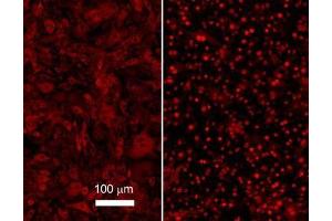 Monoclonal anti NFKB p65 (Rel A) antibody was used to detect p65 in b.